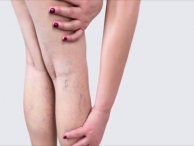 ������ �����